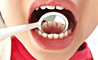 歯科医院に定期的に通う習慣